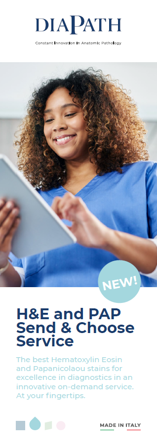 1MKT0BR169XX | Brochure Send&Choose